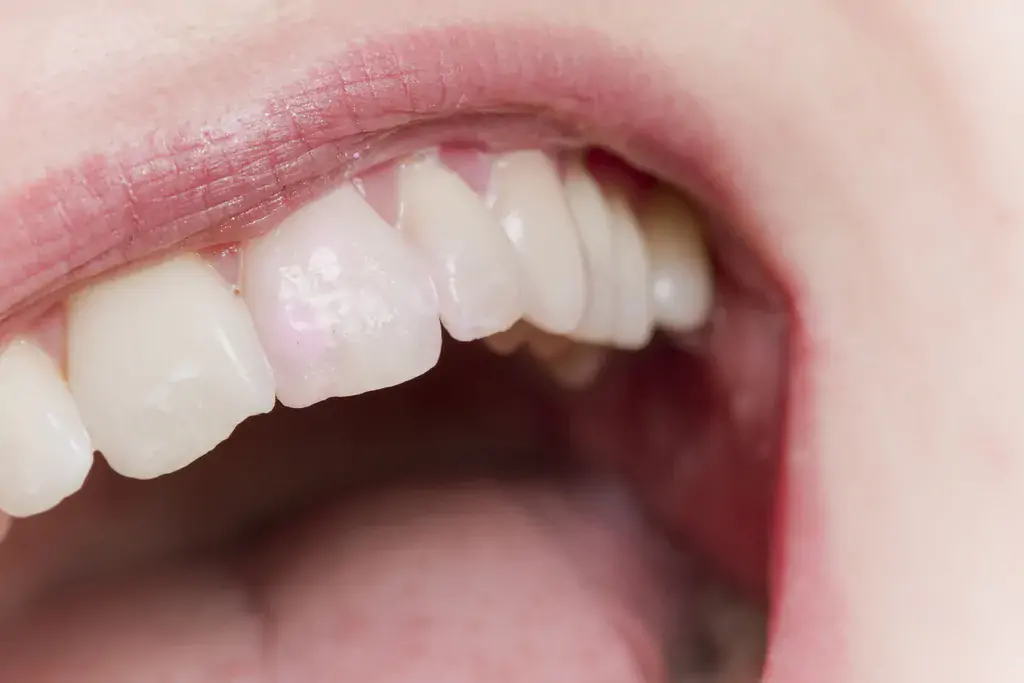 Vorteile von Zahnseide